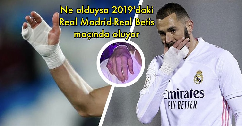 Karim Benzema'nın 2019'dan Beri Maçlara Neden Sağ Elinde Sargıyla Çıktığını Biliyor muydunuz?