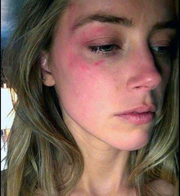 Bugüne kadar neler olmuştu? Kısaca özetleyecek olursak, önce Amber Heard eski eşi Depp'in kendisine şiddet uyguladığını iddia etmişti.