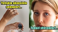 Her Yaştan Bireyin Mustarip Olduğu Yetişkin Aknesi ile Başa Çıkmanın Yolları