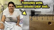 Nefes Darlığı Şikayetiyle Doktora Giden Kadının 9 Yıldır Boğazında Olan Şey Görenleri Hayrete Düşürdü!
