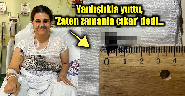 Nefes Darlığı Şikayetiyle Doktora Giden Kadının 9 Yıldır Boğazında Olan Şey Görenleri Hayrete Düşürdü!