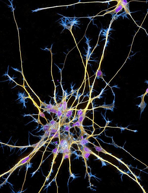 5. Kök hücrelerden nöronlar: