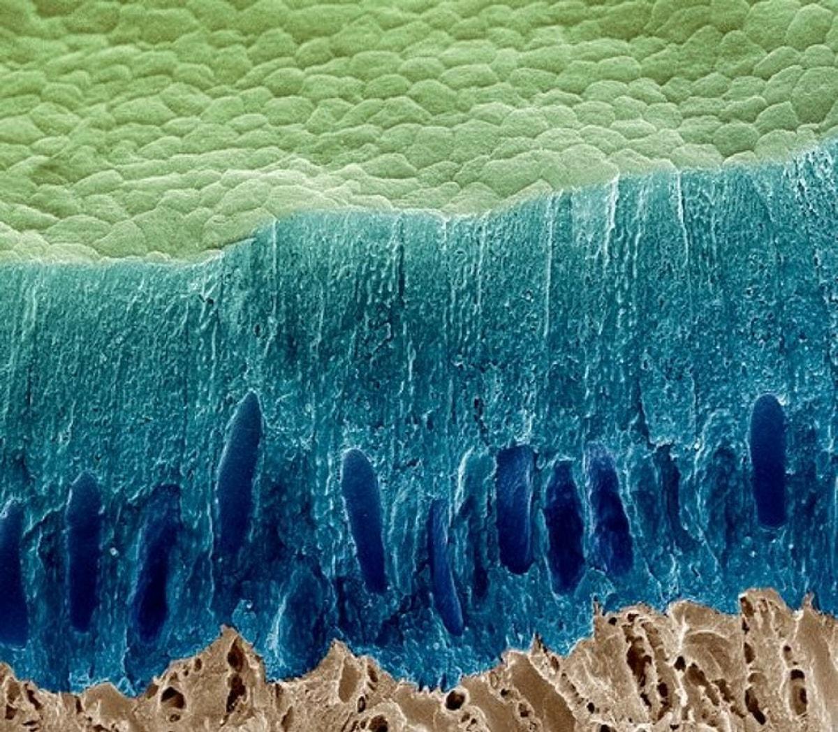 Слизистые покровы или гладкая поверхность. Кариес под микроскопом бактерии. Деттин под микроскопом. Эмаль зуба под микроскопом. Зубная эмаль под микроскопом.