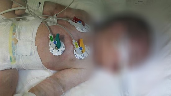 Olayı Uzman Bilirkişi Heyeti Çözecek: Doğmakta Olan Bebeği İterek Rahme Geri Sokma Davası!