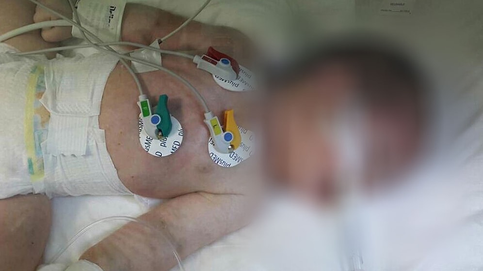 Olayı Uzman Bilirkişi Heyeti Çözecek: Doğmakta Olan Bebeği İterek Rahme Geri Sokma Davası!