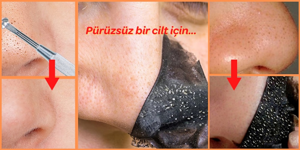 Kullananların Memnun Kaldığı En İyi Siyah Nokta Bantları