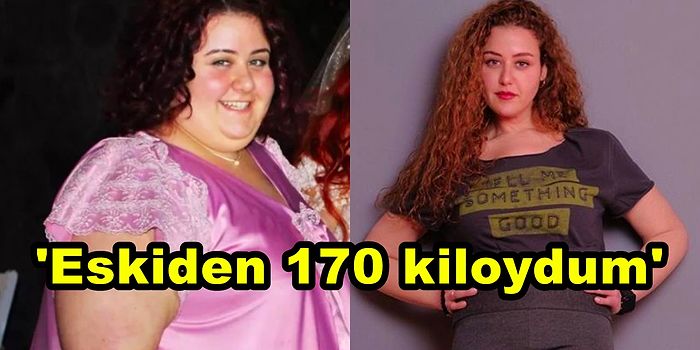 Gülümse Kaderine'de Rol Alan Hercai'nin Melike'si Aslı Samat'ın 100 Kilo Vermeden Önceki Hali Herkesi Şaşırttı