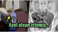 Hayatı Renklensin Diye Kendi Cinsel Oyuncağını Yapmak İsteyen Adamın Sonu Hastanede Biten Bahtsız Hikayesi