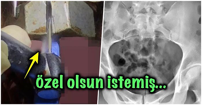 Hayatı Renklensin Diye Kendi Cinsel Oyuncağını Yapmak İsteyen Adamın Sonu Hastanede Biten Bahtsız Hikayesi