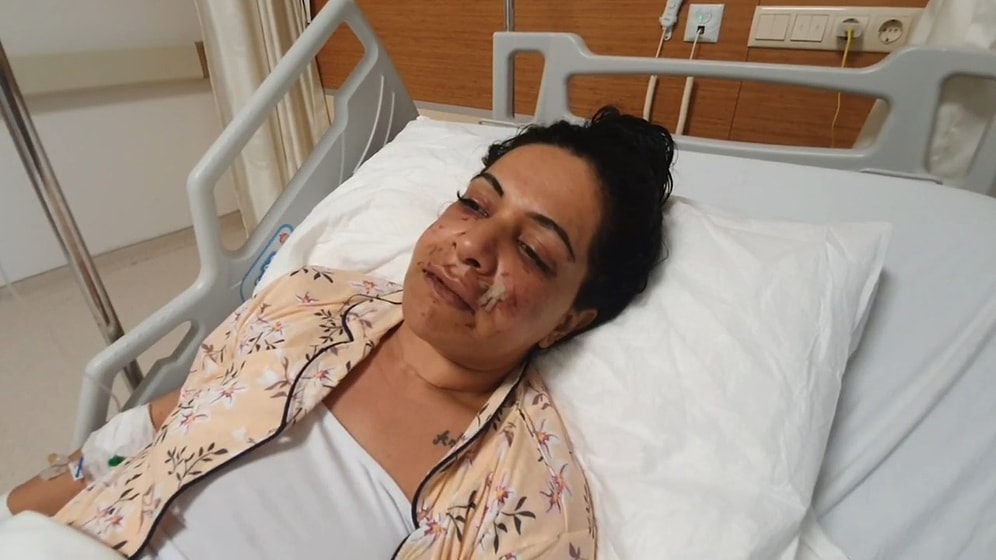 Eltisi Tarafından Yüzünden Vurulan Kadın: 'Elindeki Silahı Aldım, Belindeki Silahla Vurdu'