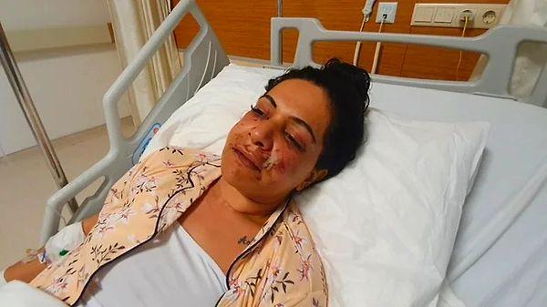 13. Sarıyer'de erkek arkadaşının abisinin eşi tarafından yüzünden vurulan kadın, "Elindeki silahı aldıktan sonra diğer silahla beni vurdu" dedi.