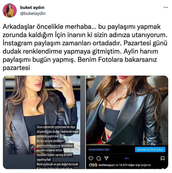 Bu iddianın ardından da Buket Aydın sosyal medya hesabından estetikçisine 2 gün önce gittiğini ve estetikçinin fotoğrafı yeni paylaştığını açıkladı.
