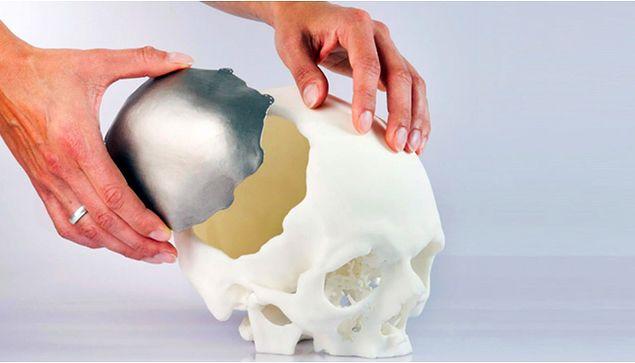2- 3D baskı teknolojisi ile üretilmiş kemikler ve organlar