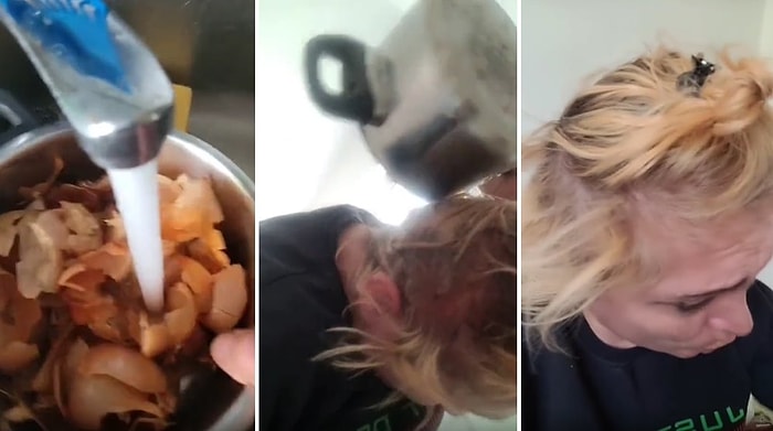 TikTokerdan Saç Dökülmesine Karşı Tavsiye: Kuru Soğan Kabuklarını Kaynatıp Suyunu Kafasına Döktü