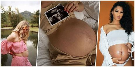 Hamilelik Sürecinin Fiziksel ve Duygusal Zorluklarına Ek Olarak Sosyal Eleştirilere Maruz Kalan Anne Adayları