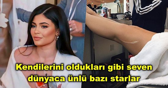 “Mükemmel” Olmadıklarını Gösteren Fotoğraflarıyla Kendimizi Sevmemiz İçin Bize İlham Veren 10 Ünlü