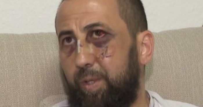 Almanya'da Polis Şiddeti: Türk Ailenin Evini Basıp Öldüresiye Dövdüler...