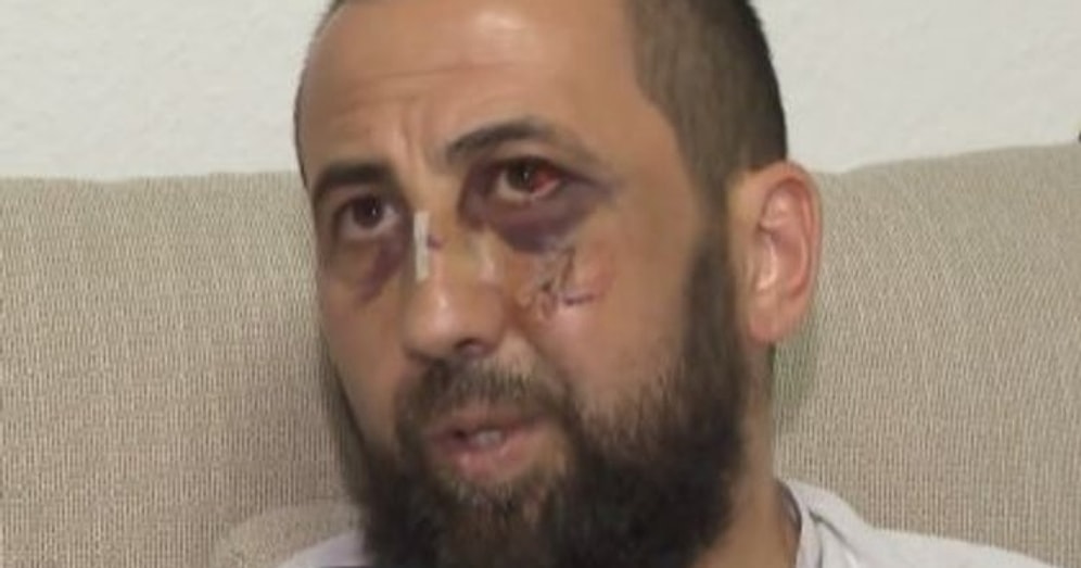 Almanya'da Polis Şiddeti: Türk Ailenin Evini Basıp Öldüresiye Dövdüler...