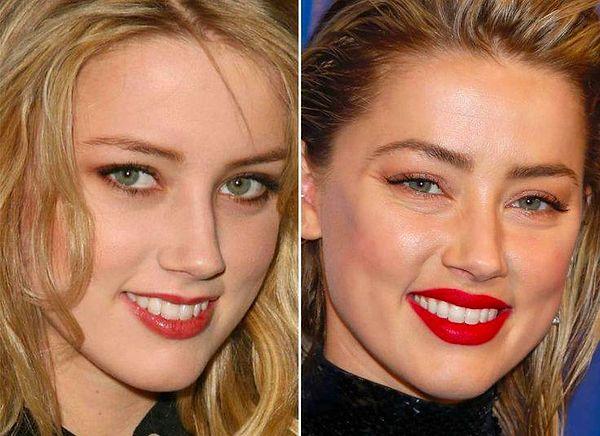 4. Amber Heard'ün yaptırdığı diğer bir işlem ise blefaroplasti yani göz kapağı estetiği.
