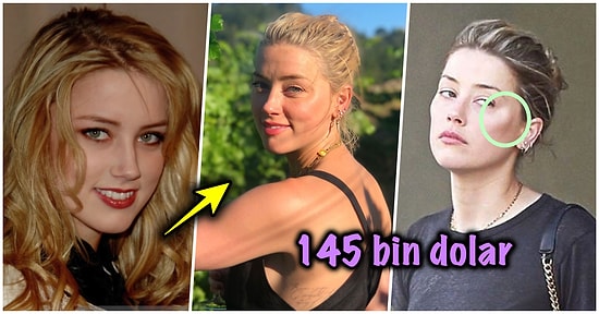 Johnny Depp ile Gündemden Düşmeyen Amber Heard'ün Geçirdiği Estetik Operasyonlarını Tek Tek İnceliyoruz!