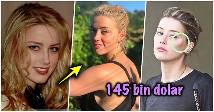 Johnny Depp ile Gündemden Düşmeyen Amber Heard'ün Geçirdiği Estetik Operasyonlarını Tek Tek İnceliyoruz!