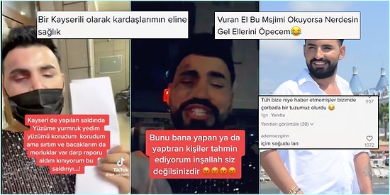 Saldırıya Uğradığını İddia Eden TikTok Fenomenine Gelen İnsanlık Dışı Yorumlar
