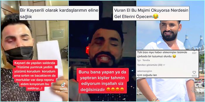 Saldırıya Uğradığını İddia Eden TikTok Fenomenine Gelen İnsanlık Dışı Yorumlar