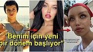 Cinsiyet Geçiş Operasyonu Geçiren Sosyal Medya Fenomeni Beren Güney'in Son Hali Takipçilerini Şaşırttı