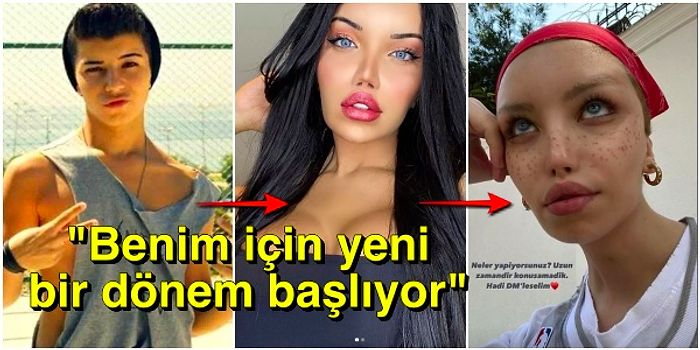 Cinsiyet Geçiş Operasyonu Geçiren Sosyal Medya Fenomeni Beren Güney'in Son Hali Takipçilerini Şaşırttı