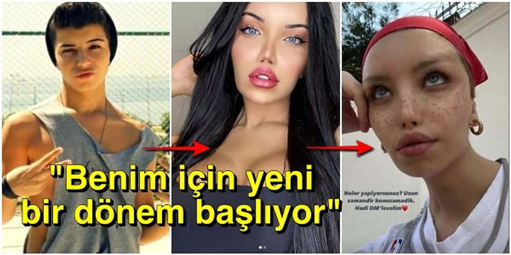 Cinsiyet Geçiş Operasyonu Geçiren Sosyal Medya Fenomeni Beren Güney'in Son Hali Takipçilerini Şaşırttı