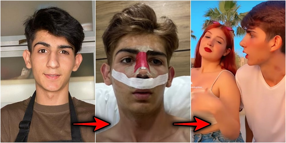 Burun Estetiği Yaptıran TikTok Fenomeni Taha Duymaz, Olağanüstü Değişimiyle Ağzımızı Açık Bıraktı!