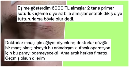 Gittikleri Hastanede Kızının Kaşına Atılan Dikişe 6000 TL Ödeyen Adam Twitter'da Tartışma Yarattı!