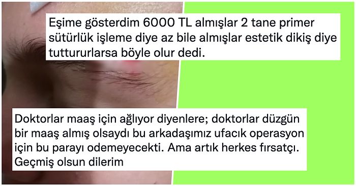 Gittikleri Hastanede Kızının Kaşına Atılan Dikişe 6000 TL Ödeyen Adam Twitter'da Tartışma Yarattı!