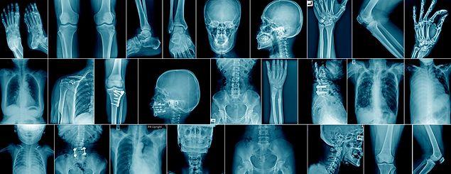 Yapay zeka talep edilmemesine rağmen röntgen görüntüleri üzerinden hastaların ırklarını da belirtmiş.