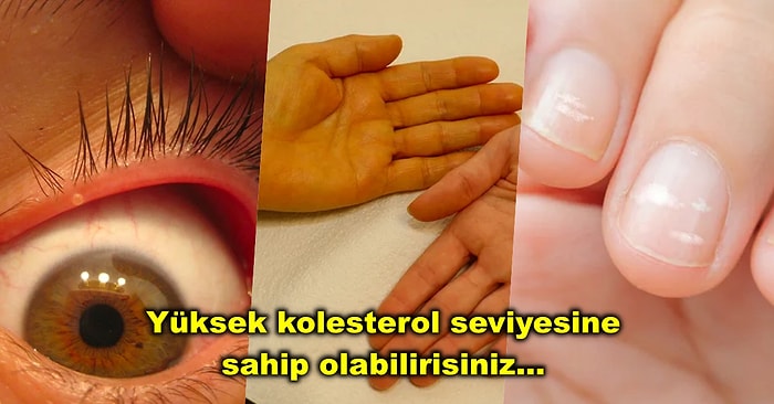 Vücudunuzun Hasta Olduğunuzda Size Verdiği ve Asla Görmezden Gelmemeniz Gereken İşaretler