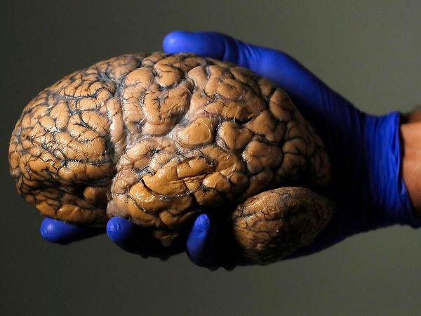 Araştırmacılar çalışma yazarlarının beyin taramalarını analiz etmek için Ohio Süper Bilgisayar Merkezi'ndeki son teknoloji yapay zeka programlarını ve diğer kaynakları kullandı.