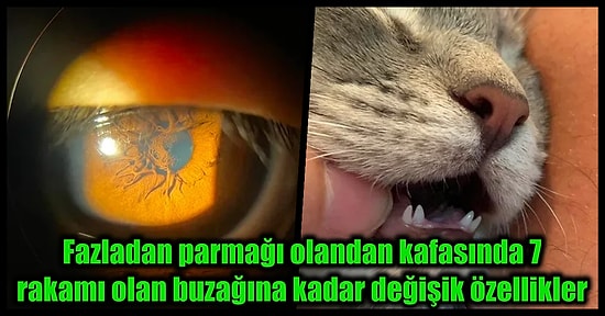 Milyonda Bir İhtimalle Rastlanan Bazı Sıra Dışı Genetik Özellikler