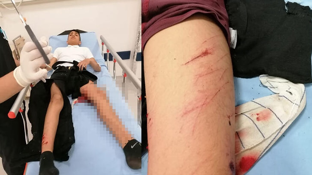 Okul Önünde Köpeklerin Saldırısına Uğradı, Hastanelik Oldu