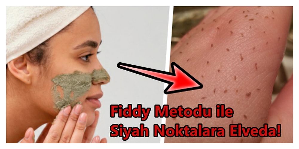 Siyah Noktaları Yok Eden Fiddy Metodu Nedir? Nasıl Uygulanır?