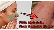 Siyah Noktaları Yok Eden Fiddy Metodu Nedir? Nasıl Uygulanır?