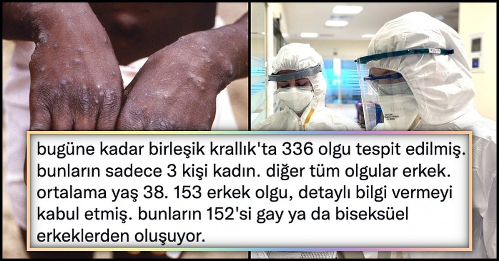 Yeni Bir Pandemiye Yol Açıp Açmayacağı Tartışılan Maymun Çiçeği Hastalığıyla İlgili Son Gelişmeler!