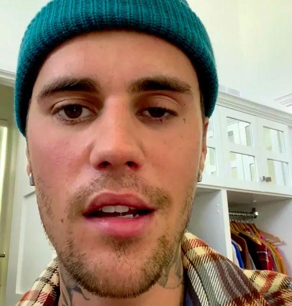 3. Dünyaca ünlü şarkıcı Justin Bieber, yüz felci geçirdiğini açıkladı! Sanatçı, rahatsızlığı nedeniyle dünya turunu iptal etti!