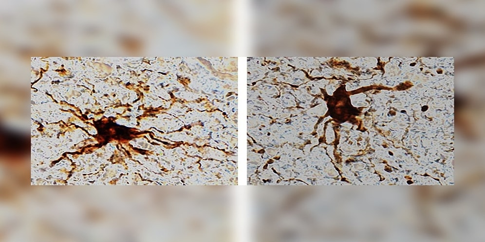 Korkut Ulucan Yazio: Zombi Genlerden Zombi Hücrelere ve Zombi Hayata