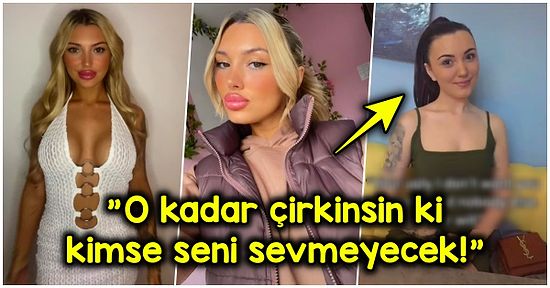 Erkek Arkadaşı Kendisini Beğenmediği İçin Defalarca Kez Estetik Yaptırıp Hayatının Pişmanlığını Yaşayan Kadın