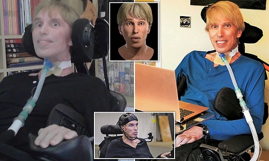 Dünyanın İlk Cyborg'u Olan Bilim İnsanı Hayatını Kaybetti