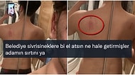 Dün Gece Ateşli Bir Sevişme Yaşadığını İma Ederek Sırtındaki İzleri Gösteren Gence Gelen Heves Kırıcı Yorumlar