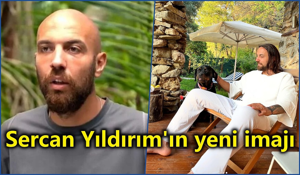 Saç Ektiren Eski Survivor Yarışmacısı Sercan Yıldırım Son Hali İle Gündem Oldu!