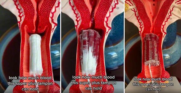 TikTok'ta paylaşılan bir videoda, vücut içerisine yerleştirilen tamponun çalışma şekli görülebiliyor.