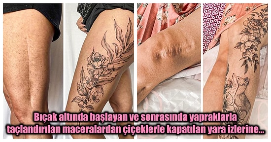 Yara İzlerini Dövmeyle Kapatarak Travmatik Deneyimlerini Sanata Dönüştüren İnsanların Fotoğrafları