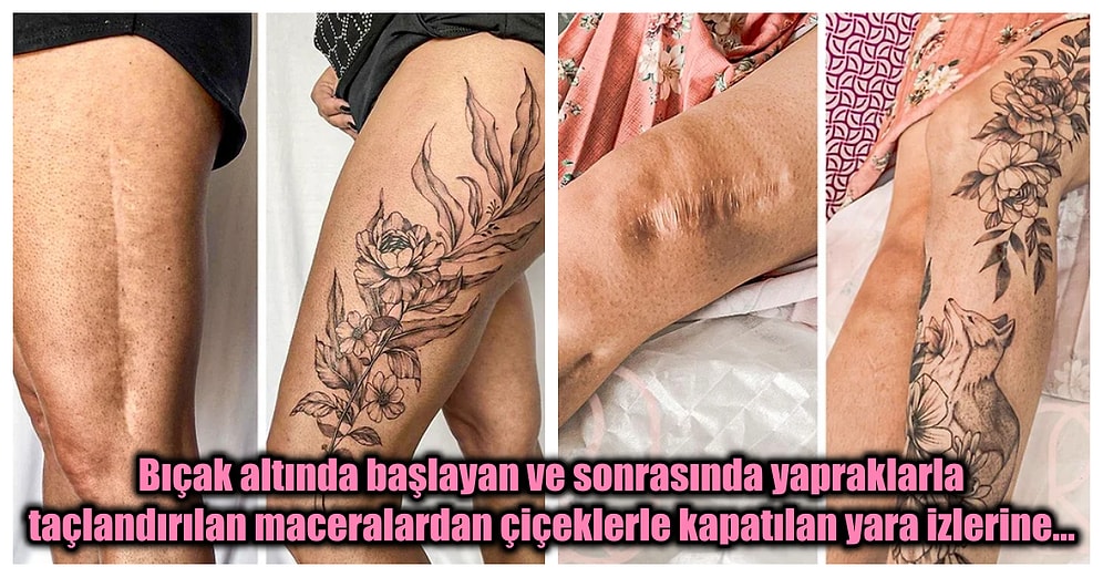 Yara İzlerini Dövmeyle Kapatarak Travmatik Deneyimlerini Sanata Dönüştüren İnsanların Fotoğrafları